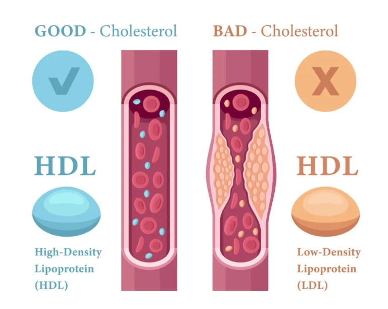 HDL કોલેસ્ટ્રોલ