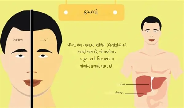 કમળો