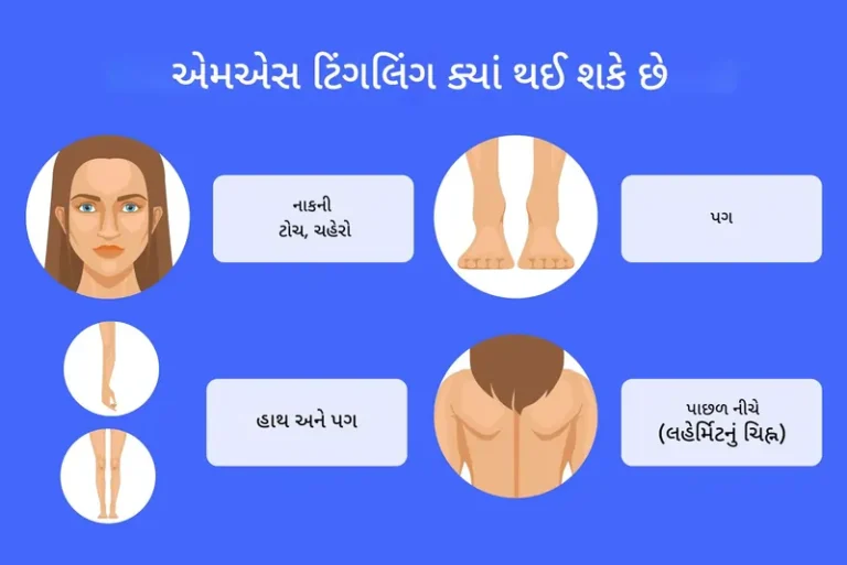 કળતર (Tingling)