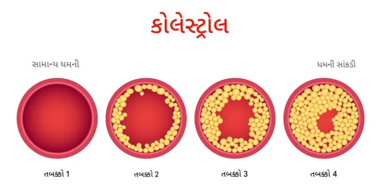 કોલેસ્ટ્રોલ