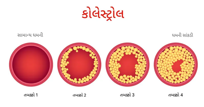 કોલેસ્ટ્રોલ