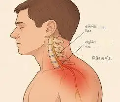 ગરદનમાં ચેતાનું સંકોચન