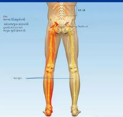 ઠના નીચેના ભાગમાં ચેતાનું સંકોચન