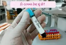 ડી-ડાયમર ટેસ્ટ