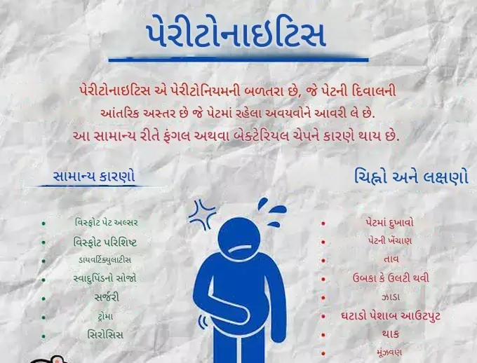 પેરીટોનાઇટિસ