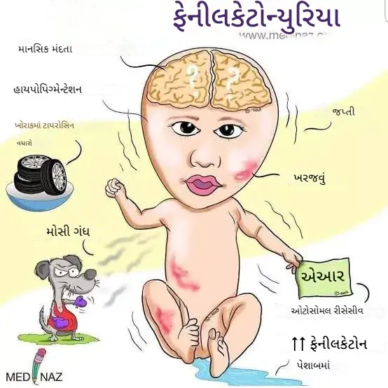 ફિનાઇલકેટોન્યુરિયા