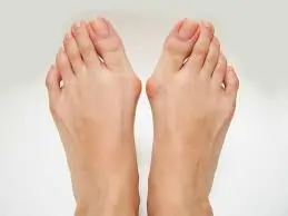 બ્યુનિયન્સ