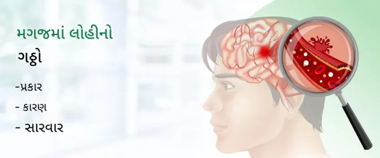 મગજમાં લોહી ગંઠાઈ જવું