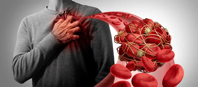 લોહી ગંઠાઈ જવામાં મુશ્કેલી