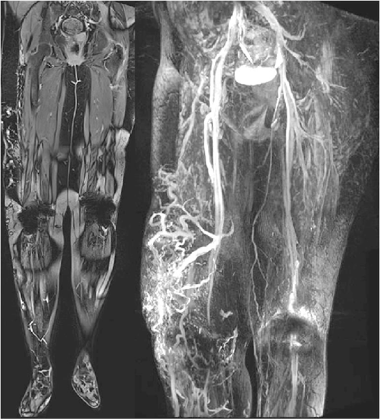 વેનોગ્રામ