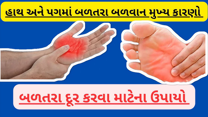 હાથ પગ માં બળતરા