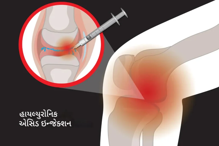 હાયલ્યુરોનિક એસિડ ઇન્જેક્શન