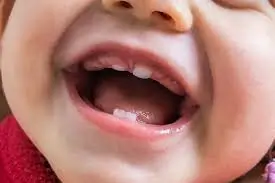બાળકને દાંત ક્યારે આવે