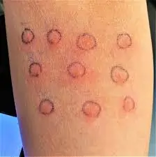 પેટર્જી ટેસ્ટ