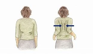 શોલ્ડર બ્લેડ સ્ક્વીઝ