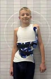 બાળકોમાં સ્કોલિઓસિસ માટે કાળજી