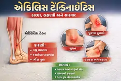 એકિલિસ ટેન્ડિનાઇટિસ