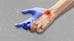 આઈટી (IT) પ્રોફેશનલ્સ માટે કાંડાના દુખાવા (Carpal Tunnel) થી બચવાના ઉપાયો.