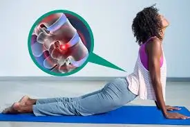 સ્લિપ ડિસ્ક (Slipped Disc) શું છે? તેના માટે શ્રેષ્ઠ કસરતો