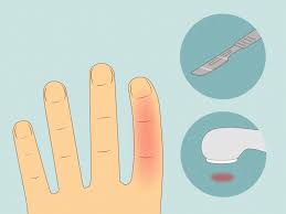 બાળકોમાં જોવા મળતા 'રાઈટિંગ ક્રેમ્પ' (લખતી વખતે હાથ દુખવો) નો ઈલાજ.