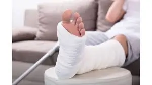 ફ્રેક્ચર પછી પ્લાસ્ટર ખૂલ્યા બાદ જકડાયેલા સાંધાને કઈ રીતે ખોલવા?