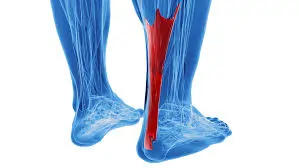 એકિલીસ ટેન્ડિનાઇટિસ (Achilles Tendinitis): એડીના પાછળના ભાગના દુખાવાનો ઈલાજ.