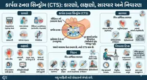 કાર્પલ ટનલ સિન્ડ્રોમ (CTS): કારણો, લક્ષણો, સારવાર અને અટકાવવાના ઉપાયોની સંપૂર્ણ માહિતી