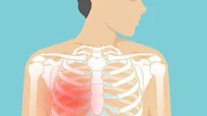 છાતીના પાંસળીના ભાગમાં થતો દુખાવો (Costochondritis) અને શ્વાસ લેવાની કસરતો.