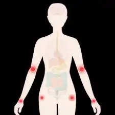 મેનોપોઝ (Menopause) દરમિયાન સ્નાયુઓ અને સાંધાઓના અસહ્ય દુખાવાનું મેનેજમેન્ટ.