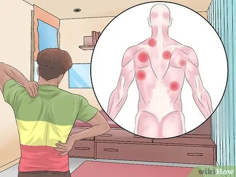 'ટેન્શન' ના કારણે ગરદનની પાછળ ભરાઈ જતી સ્નાયુઓની ગાંઠો (Muscle Knots) કેવી રીતે ઓગાળવી?