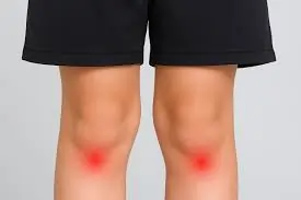 બાળકોમાં ઑસ્ગુડ-શ્લેટર ડિસીઝ (Osgood-Schlatter): રમતી વખતે ઘૂંટણની નીચેનો દુખાવો.