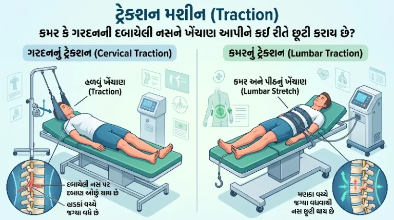 ટ્રેક્શન મશીન દબાયેલી નસમાં કેવી રીતે રાહત આપે
