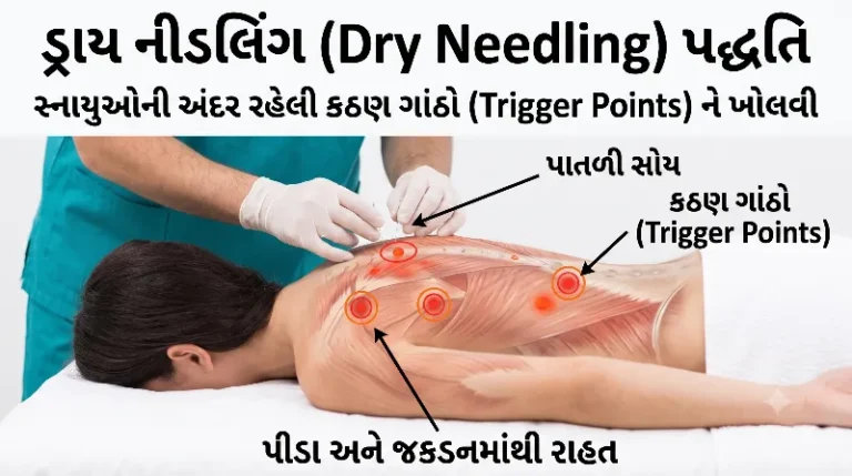 ડ્રાય નીડલિંગ સ્નાયુની ગાંઠ અને દુખાવાની સારવાર