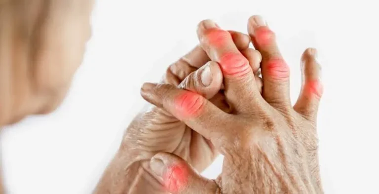 ફેક્ટ ચેક: શું ટચાકા ફોડવાથી (Cracking Knuckles) સાંધામાં વા થાય છે?