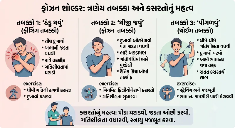 ફ્રોઝન શોલ્ડરના ત્રણેય તબક્કા અને તેમાં કસરતોનું મહત્વ
