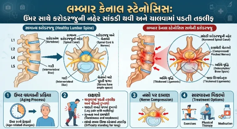 લમ્બાર કેનાલ સ્ટેનોસિસ ઉંમર સાથે કમરની નસની જગ્યા સાંકડી થવી અને ચાલવામાં પડતી તકલીફ